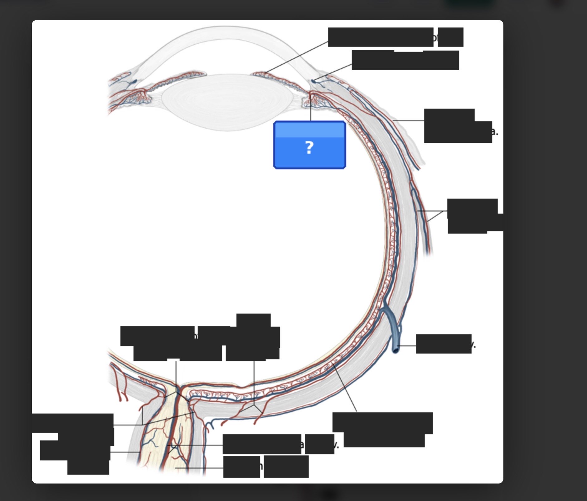 Image occlusion card with blackout mode - other labels are hidden